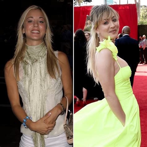 Kaley Cuoco Breast Implants: Her Plastic Surgery Transformation